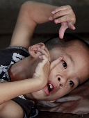 Nỗi đau từ dioxin